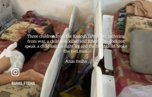 Thumbnail preview image for the video titled: 3 children from the Kadosh family maimed differently