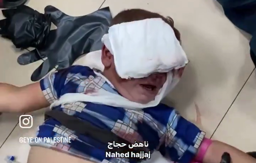 Thumbnail preview image for the video titled: Toddler injured in IDF strikes on Deir al-Balah cries in pain