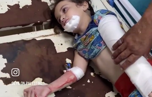 Thumbnail preview image for the video titled: Children injured in strikes on Nuseirat