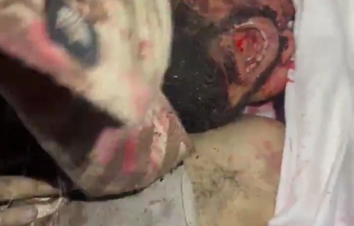 Thumbnail preview image for the video titled: Abu Nada family massacre: Young man's had cracked open