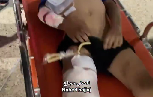 Thumbnail preview image for the video titled: Children injured in Nuseirat midnight strike