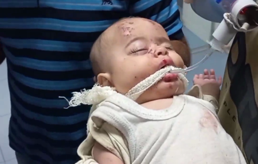 Thumbnail preview image for the video titled: Al-Ahli hospital strike: staff try to save injured children