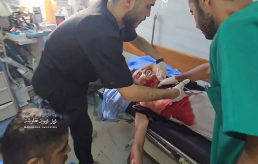 Thumbnail preview image for the video titled: Injuries taken to hospital after airstrike at the entrance of Al-Fakhoura school