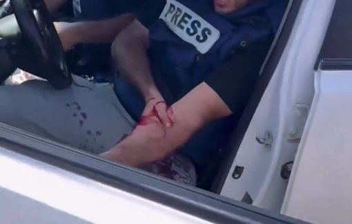 Thumbnail preview image for the video titled: Journalists injured by IDF gunfire