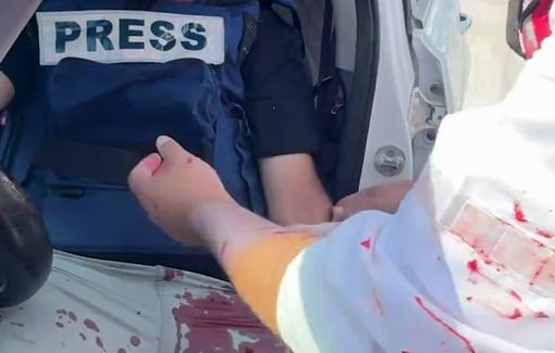 Thumbnail preview image for the video titled: First aid after IDF shot on two journalists from the WAFA news agency were traveling by car in Kafr Dan