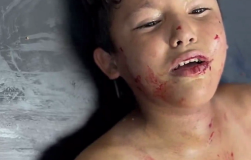 Thumbnail preview image for the video titled: Child injured in Israeli assault on civilians near Kamal Adwan hospital