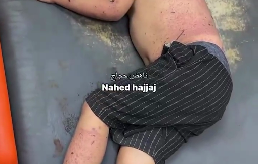 Thumbnail preview image for the video titled: Child from the Farajallah family injured in IDF strike on his home