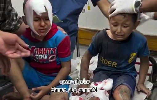 Thumbnail preview image for the video titled: Qandil family children injured in strike on their home