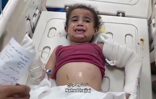 Thumbnail preview image for the video titled: Children injured in strike on Eid family home in Nuseirat