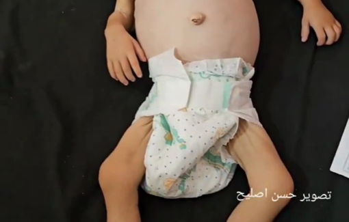 Thumbnail preview image for the video titled: Infant killed by Israel's policy of starvation and blocking aid