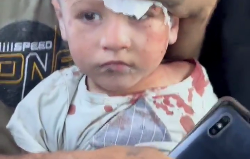 Thumbnail preview image for the video titled: Journalist take child injured in Hinnawi family massacre to hospital