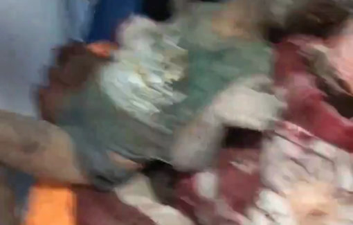 Thumbnail preview image for the video titled: Children's limbs severed in Israeli massacre on Mawasi tent camp