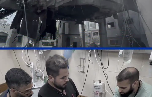 Thumbnail preview image for the video titled: Wounded brought to Al Aqsa Hospital after 3 missiles hit Bureij camp