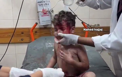 Thumbnail preview image for the video titled: Toddler injured by missile-strike on Al-Farouq Mosque