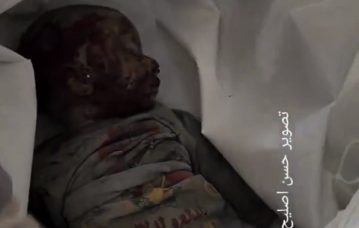 Thumbnail preview image for the video titled: Infant Mansur Al-Bayyouk kiled and another family member torn to shreds