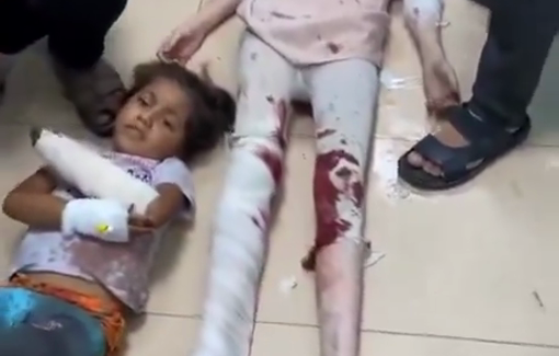 Thumbnail preview image for the video titled: Palestinian children injured in a massacre committed by IDF in Al-Jaouni School