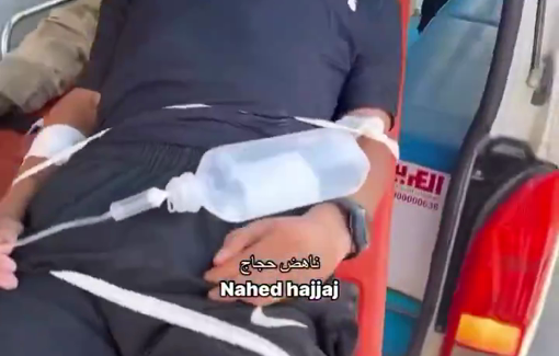 Thumbnail preview image for the video titled: Injuries arrive at Al Aqsa hospital following the IDF bombing of the Al-Jaouni School