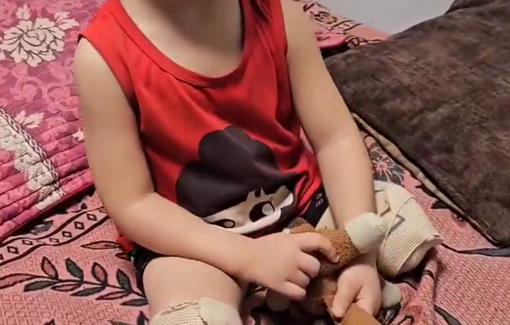 Thumbnail preview image for the video titled: Rahaf Saad had her lower limbs amputated in an Israeli bombardment