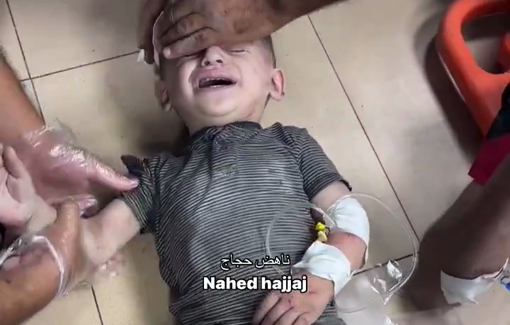 Thumbnail preview image for the video titled: Imad family triaged at Al-Aqsa Hospital - wounded children