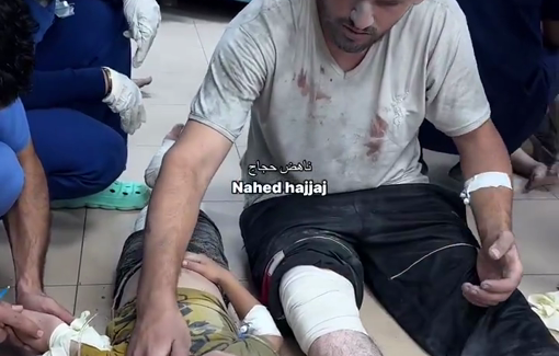 Thumbnail preview image for the video titled: Injured father comforts his wounded child at Al-Aqsa Hospital