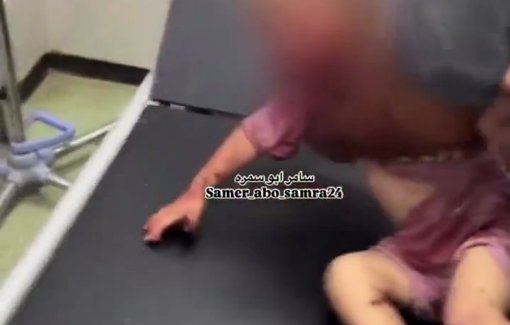 Thumbnail preview image for the video titled: Infant injured in IDF strike on Al-Sumud camp