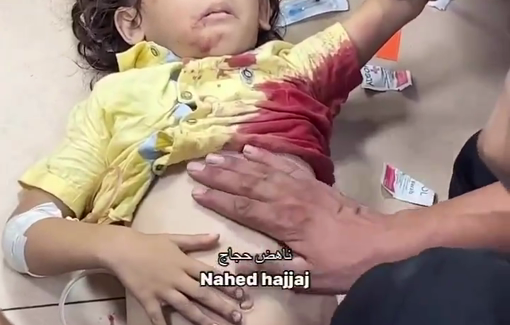 Thumbnail preview image for the video titled: Little girl from the Al-Ahli Club treated on the hospital floor in Al-Awda