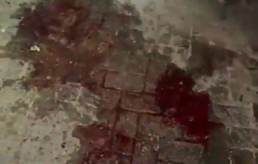 Thumbnail preview image for the video titled: Flesh pieces and bloodstains on the street