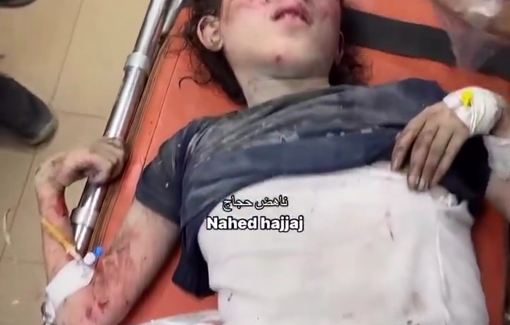 Thumbnail preview image for the video titled: Children injured in Israeli strike on Ilya Tower, Nuseirat