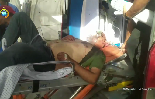 Thumbnail preview image for the video titled: Man injured in air strike on minibus