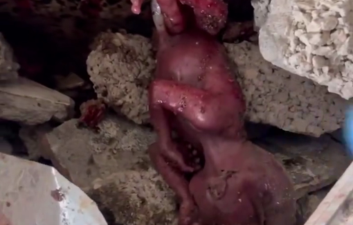 Thumbnail preview image for the video titled: Fetus found thrown out of his mother's womb