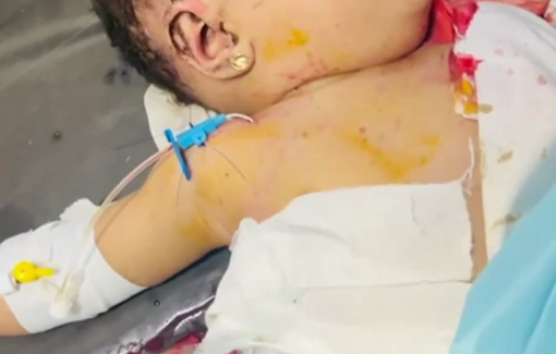 Thumbnail preview image for the video titled: Baby sustained burns and injuries in Zaitoun school massacre