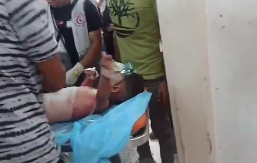 Thumbnail preview image for the video titled: Little boy sustained burns in IDF school massacre