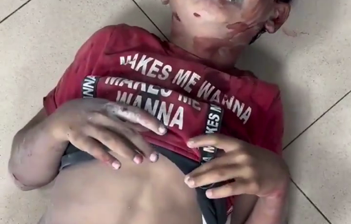 Thumbnail preview image for the video titled: Wounded & traumatized children of the Dawas family