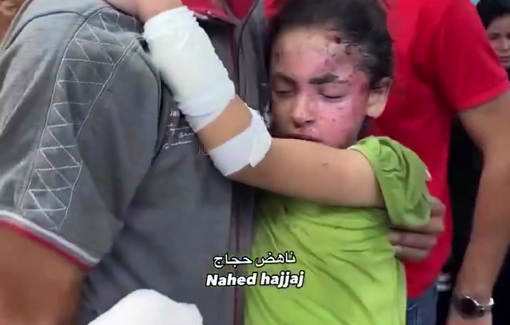 Thumbnail preview image for the video titled: Children injured in Israeli massacre of Al-Wasifi family