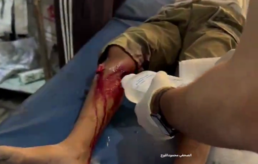 Thumbnail preview image for the video titled: Girl shot in the foot by IDF boats on the coast of Nuseirat