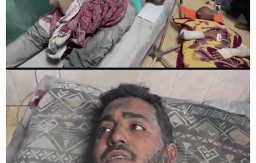 Thumbnail preview image for the video titled: Photojournalist Ahmed Al-Zard grieves through his injury for his family murdered in Israeli assault