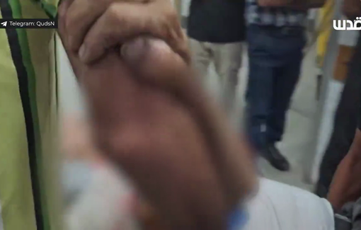 Thumbnail preview image for the video titled: More casualties from Israeli assault in north Gaza brought to hospital