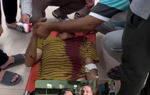 Thumbnail preview image for the video titled: Journalist Ali Al-Attar still bleeding one day after IDF drone strikes him