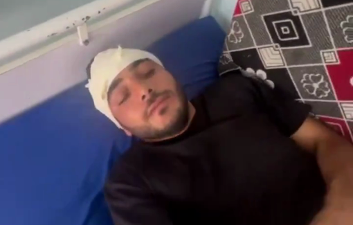 Thumbnail preview image for the video titled: The Journalist Ali Al-Attar was injured by two shrapnels that lodged in the middle of his head