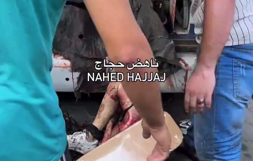 Thumbnail preview image for the video titled: Mangled bodies of children pile up in ambulance after IDF massacre at Rufaida school