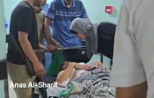 Thumbnail preview image for the video titled: Journalist Fadi Al-Wahidi enters the operating room