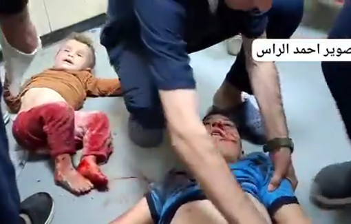 Thumbnail preview image for the video titled: Al-Kurd children injured in midnight IDF strike on their home