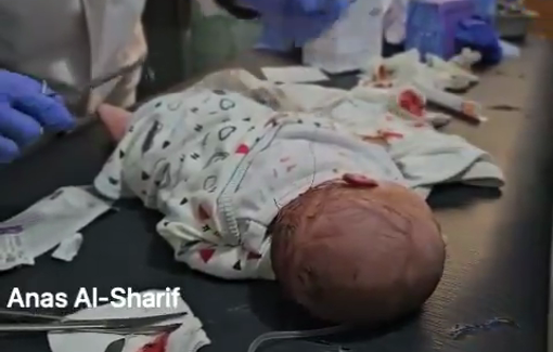 Thumbnail preview image for the video titled: 10-hours old newborn injured in Israeli strike on her family home