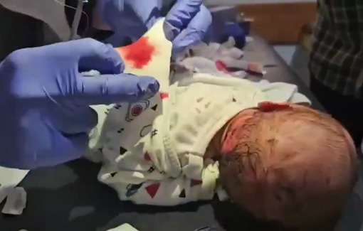 Thumbnail preview image for the video titled: Injured newborn receives treatment mere hours after she came into the world