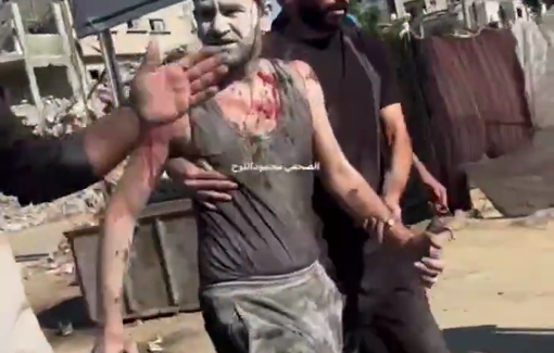 Thumbnail preview image for the video titled: Man injured in Israeli strike walks to Al-Awda hospital