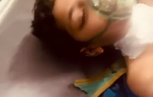 Thumbnail preview image for the video titled: Child injured by shrapnel from an Israeli strike on a Gaza City school