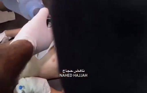 Thumbnail preview image for the video titled: Infant injured in Israeli strike on Mufti school