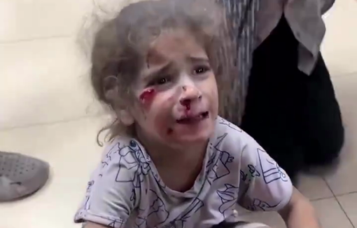 Thumbnail preview image for the video titled: Scared little girl injured in IDF massacre of Shana'a family