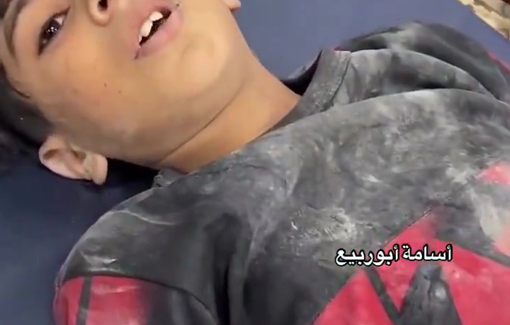 Thumbnail preview image for the video titled: Child injured by Israeli shelling on his home in Saftawi