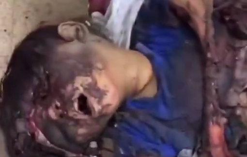 Thumbnail preview image for the video titled: Multiple children killed in IDF bombardment, mangled and disfigured